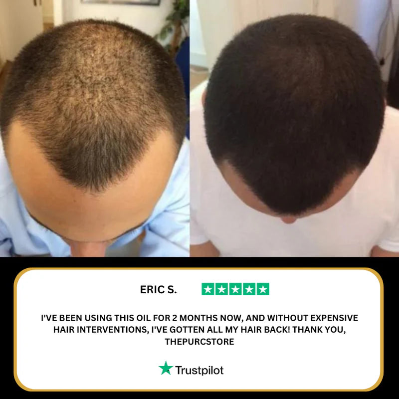 Nevaniya pure Hair Growth Oil – Bring Your Hair Back. Naturally.