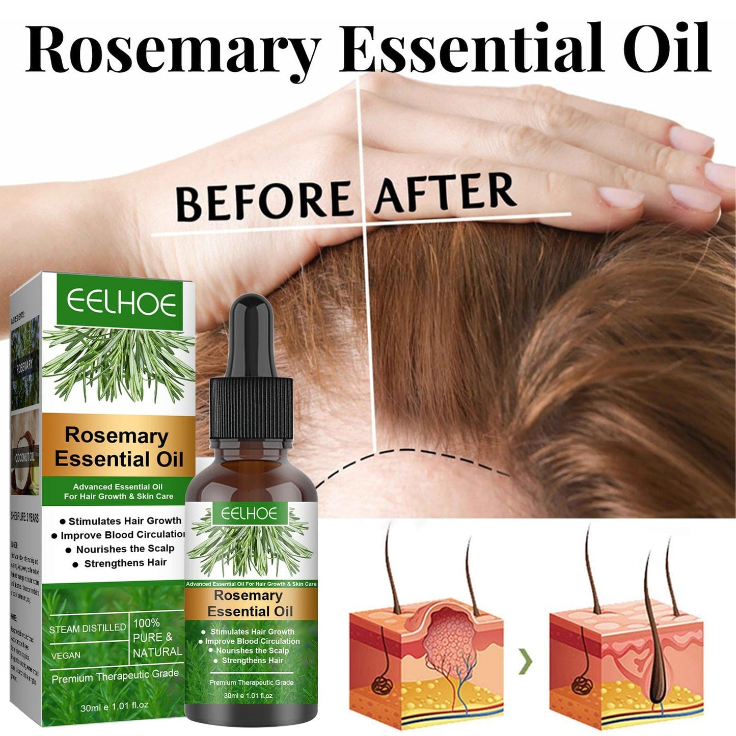 Nevaniya- Rosemary hair growth Oil- 🎁 FREE