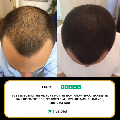 Nevaniya pure Hair Growth Oil – Bring Your Hair Back. Naturally.
